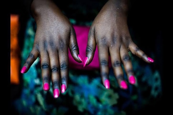 Deep-Seated Skin Bleaching Culture in Nigeria